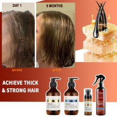 Biotin Hair Growth Serum Shampoo & Conditioner