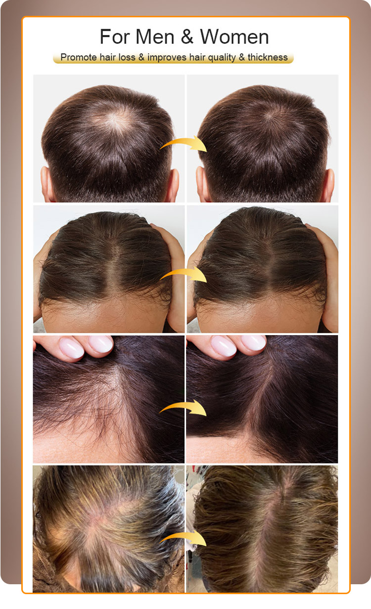 Biotin Hair Growth Serum Shampoo & Conditioner