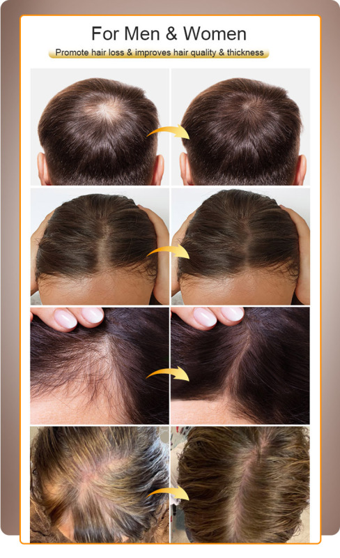 Biotin Hair Growth Serum Shampoo & Conditioner