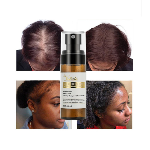 Organic natural fast growing hair serum rosemary oil mist hair spray growth products for man 100ml