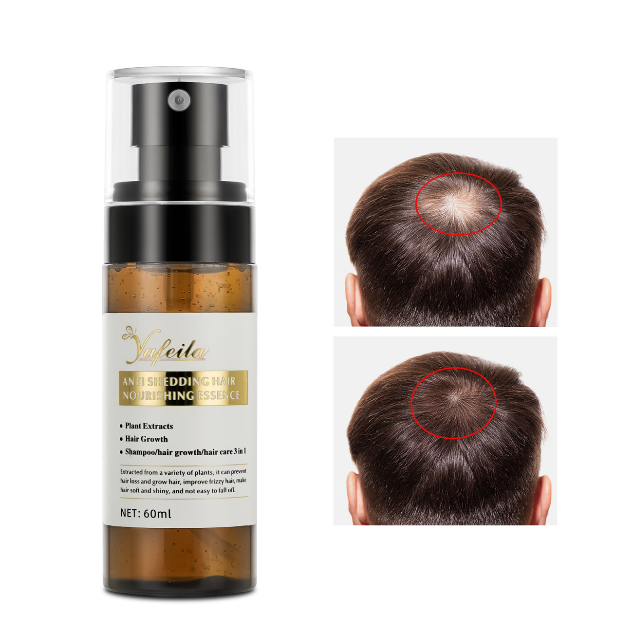 Organic natural fast growing hair serum rosemary oil mist hair spray growth products for man 100ml