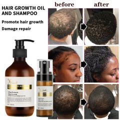 Organic natural fast growing hair serum rosemary oil mist hair spray growth products for man 100ml