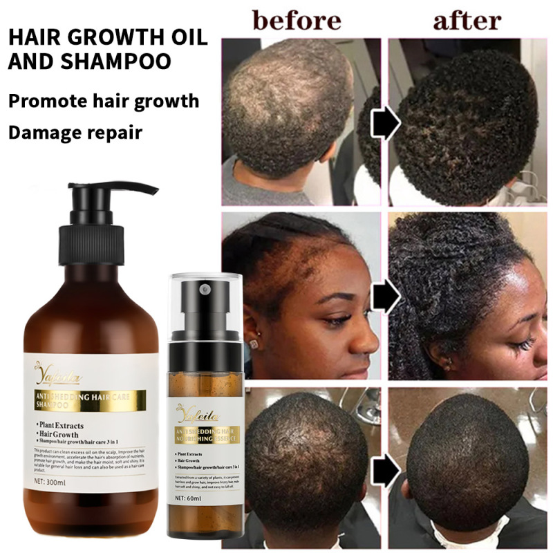 Organic natural fast growing hair serum rosemary oil mist hair spray growth products for man 100ml