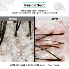 Fresh Menthol Anti Dandruff Shampoo for Man