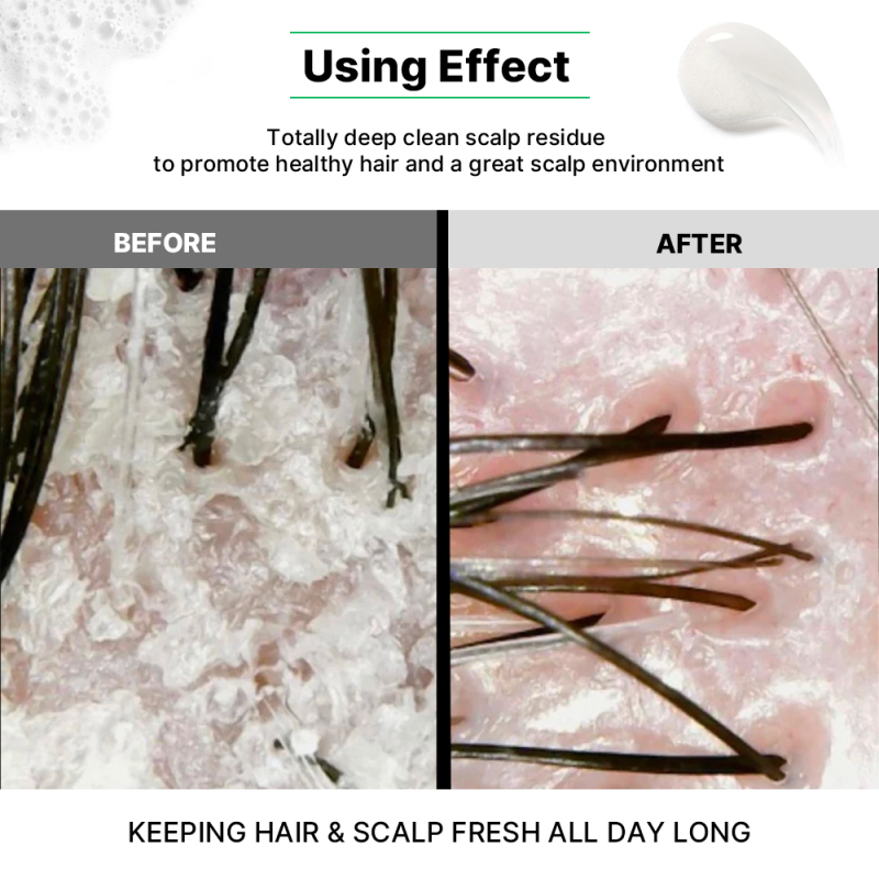 Fresh Menthol Anti Dandruff Shampoo for Man