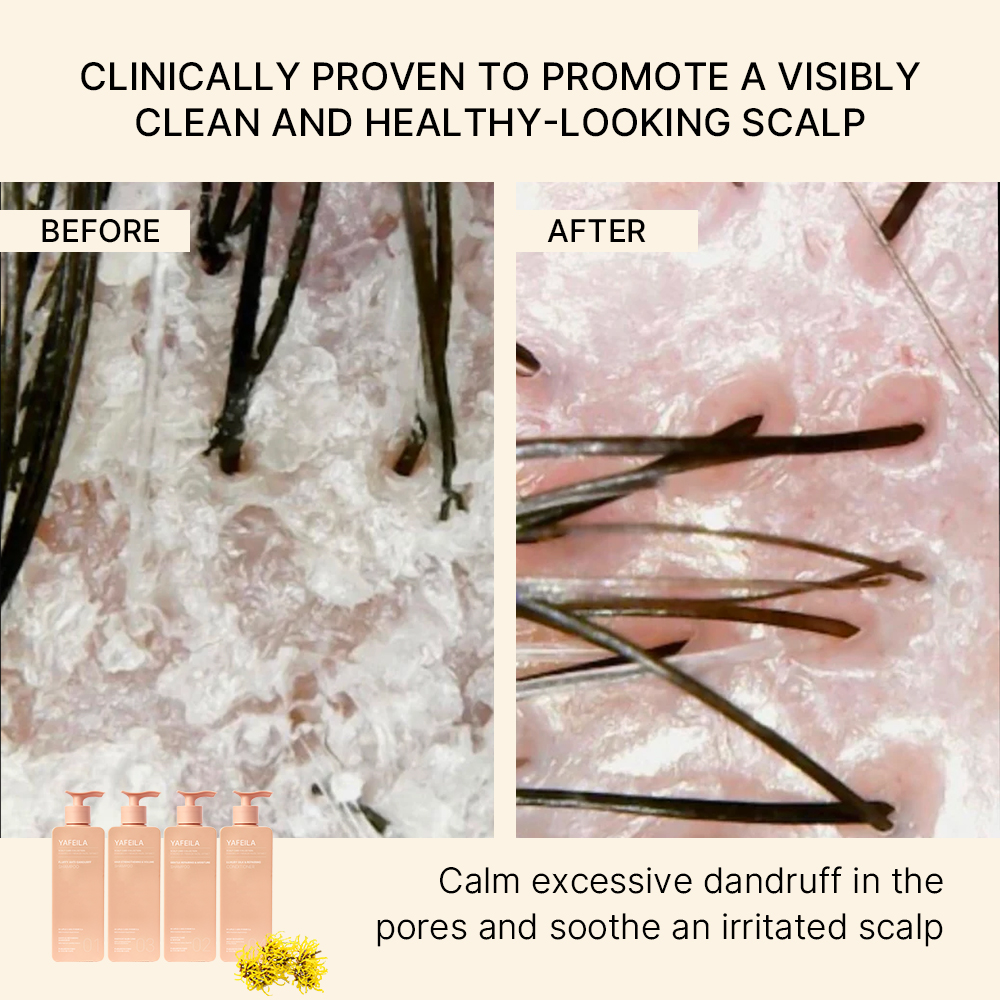 Witch Hazel Scalp Purifying and Hair Care Collection