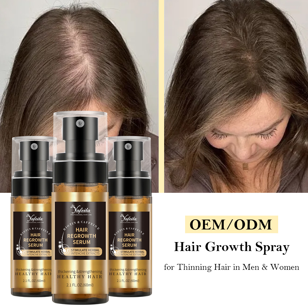 Minoxidil + Biotin Hair Growth Spray - Anti Hair Loss DHT Blocker Scalp Tonic