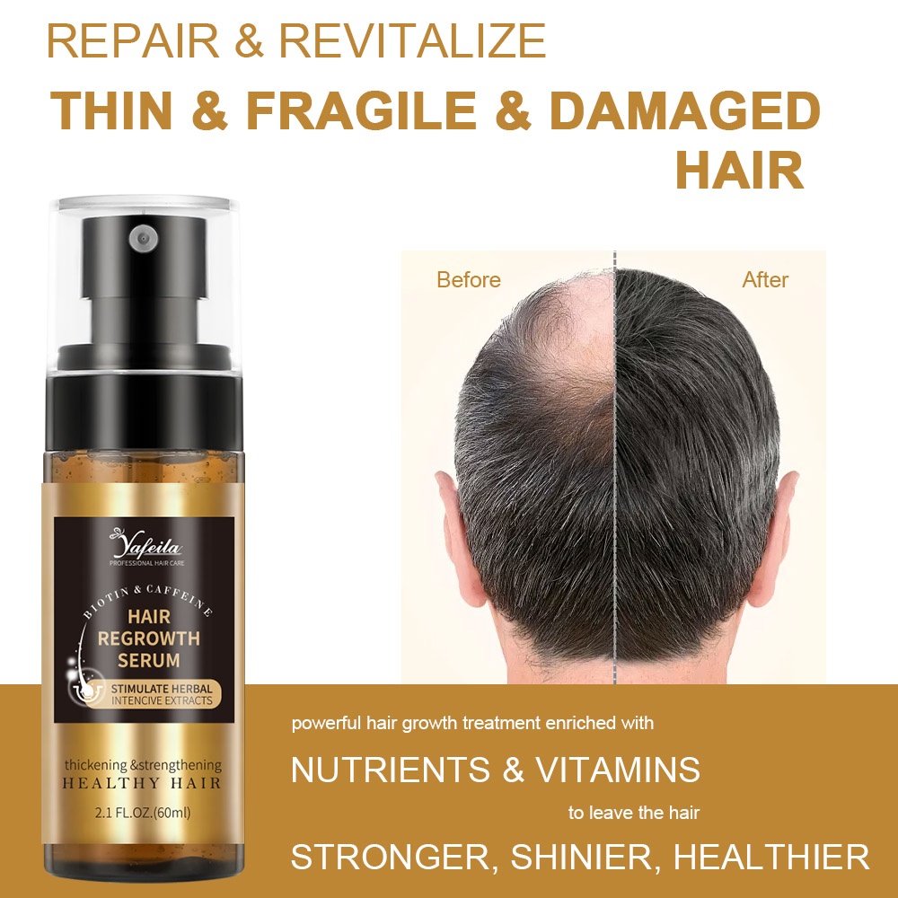 Minoxidil + Biotin Hair Growth Spray - Anti Hair Loss DHT Blocker Scalp Tonic