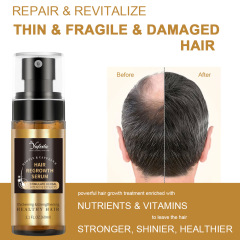 Minoxidil + Biotin Hair Growth Spray - Anti Hair Loss DHT Blocker Scalp Tonic