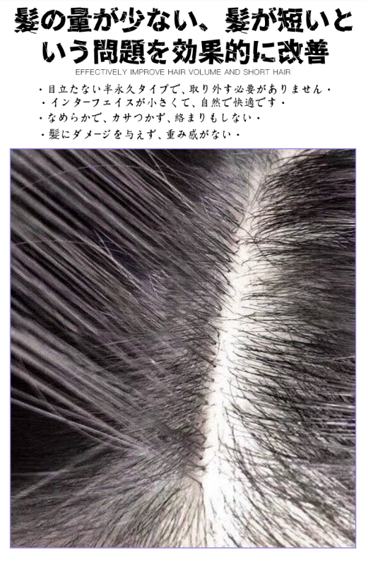 物理増毛エクステンション｜自然な髪のボリュームアップ｜軽量で快適な装着感｜男性・女性用ヘアエクステンション