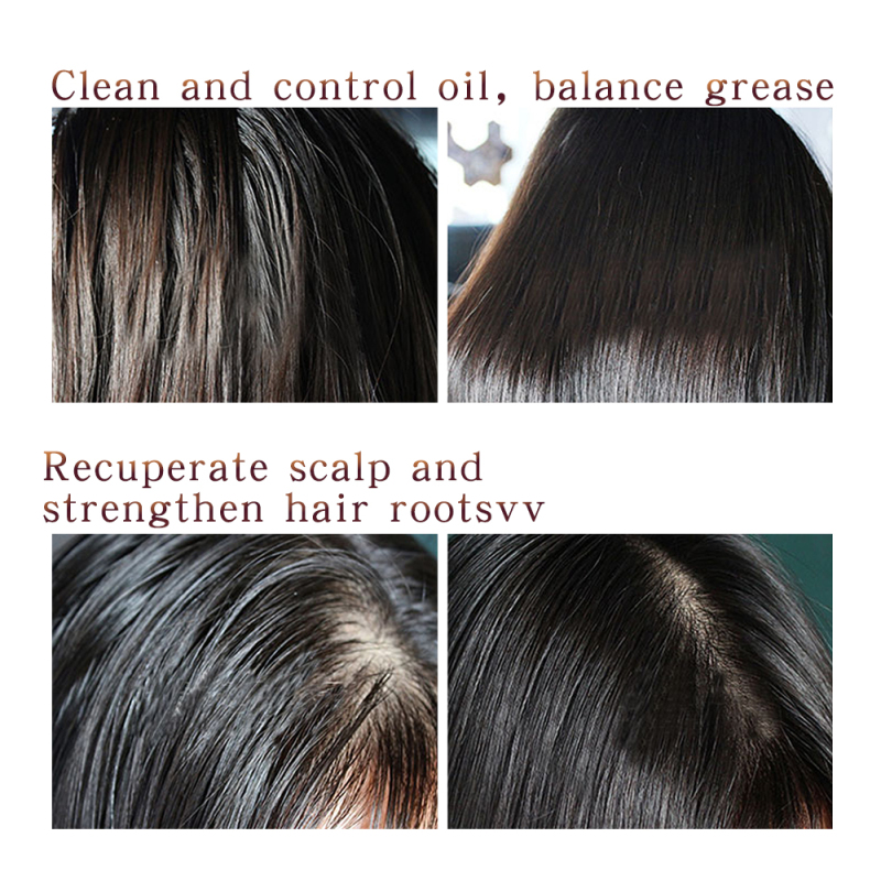 wholesale 500ml ginger hair shampoo