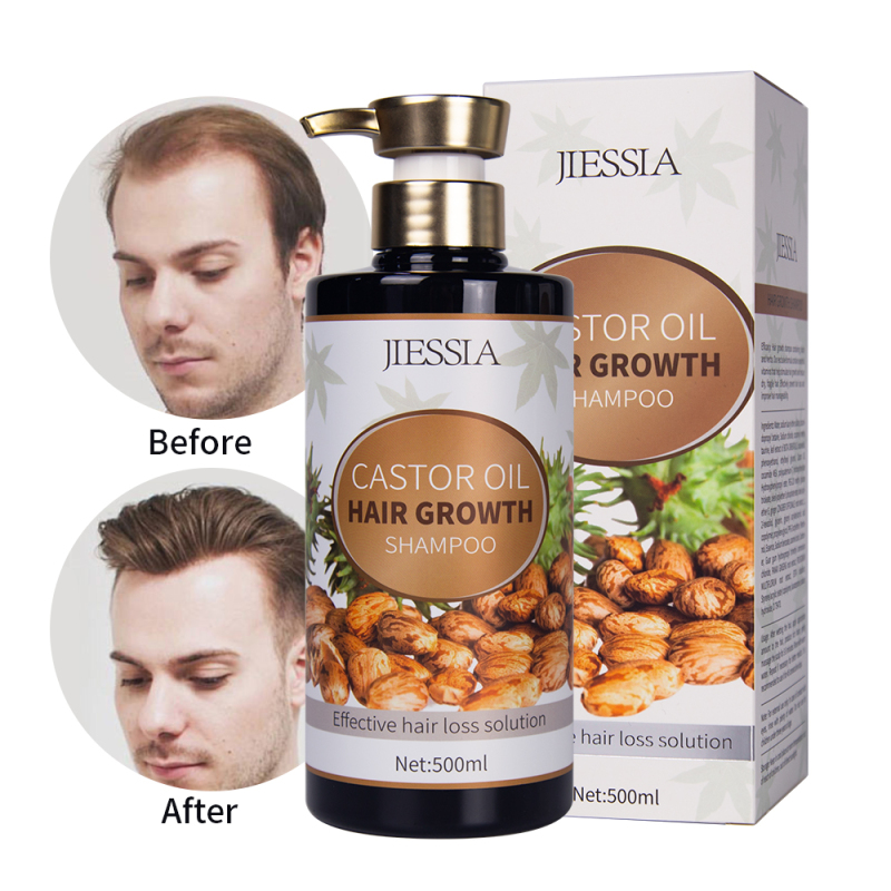 New products Jiessia castor oil hair growth shampoo 500ml castor oil anti hair loss shampoo