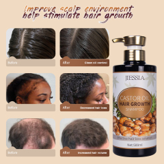 New products Jiessia castor oil hair growth shampoo 500ml castor oil anti hair loss shampoo