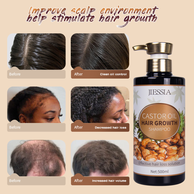 New products Jiessia castor oil hair growth shampoo 500ml castor oil anti hair loss shampoo