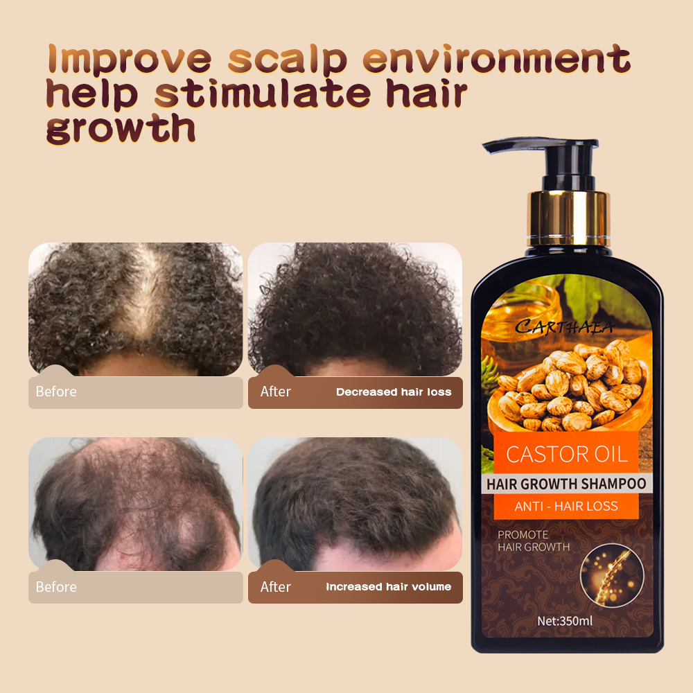 350ml New products hair care castor oil hair growth shampoo anti hair loss shampoo