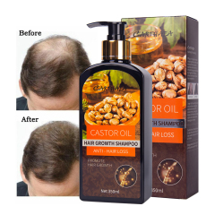 350ml New products hair care castor oil hair growth shampoo anti hair loss shampoo