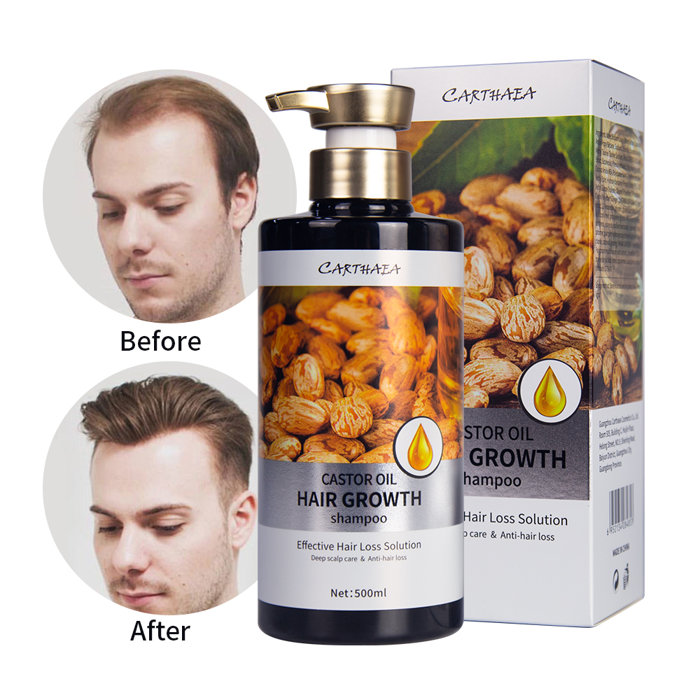 New products Jiessia castor oil hair growth shampoo 500ml castor oil ...