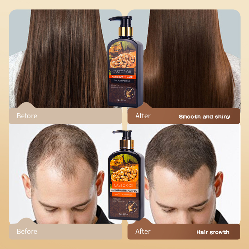 350ml wholesale hair care treatment castor oil repair damaged hair growth mask anti hair loss hair mask