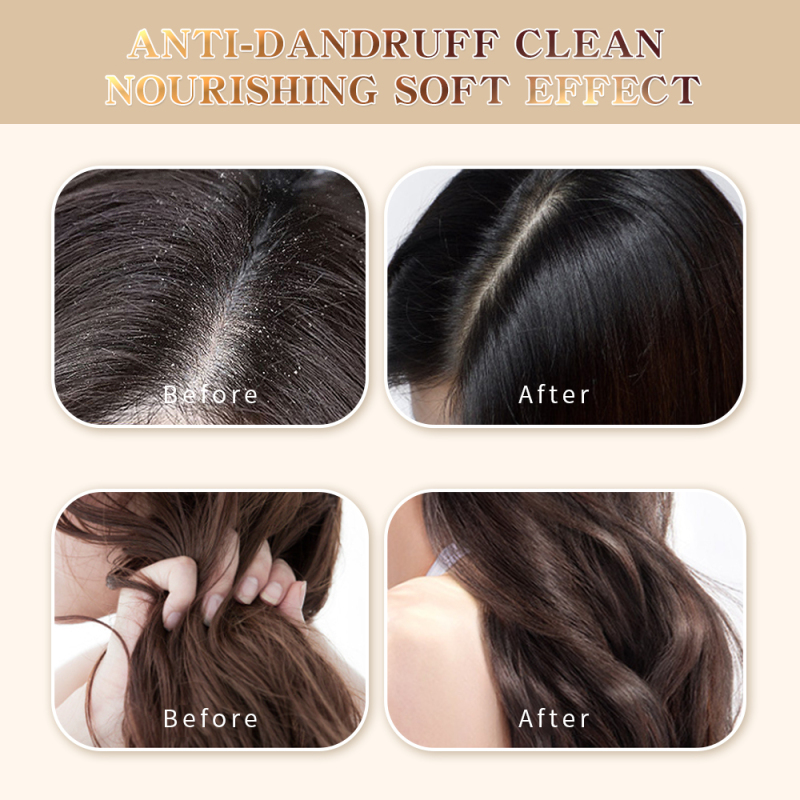 Augeas hair care treatment anti frizz keratin collagen scalp care hair shampoo and conditioner set