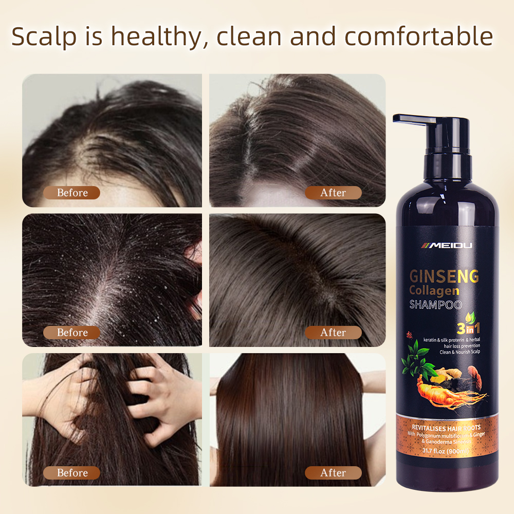 Wholesale meidu collagen herbal ginger natural anti dandruff control oil hair shampoo mask oil hair care set