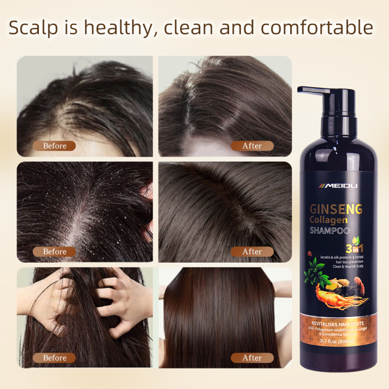 Wholesale meidu collagen herbal ginger natural anti dandruff control oil hair shampoo mask oil hair care set