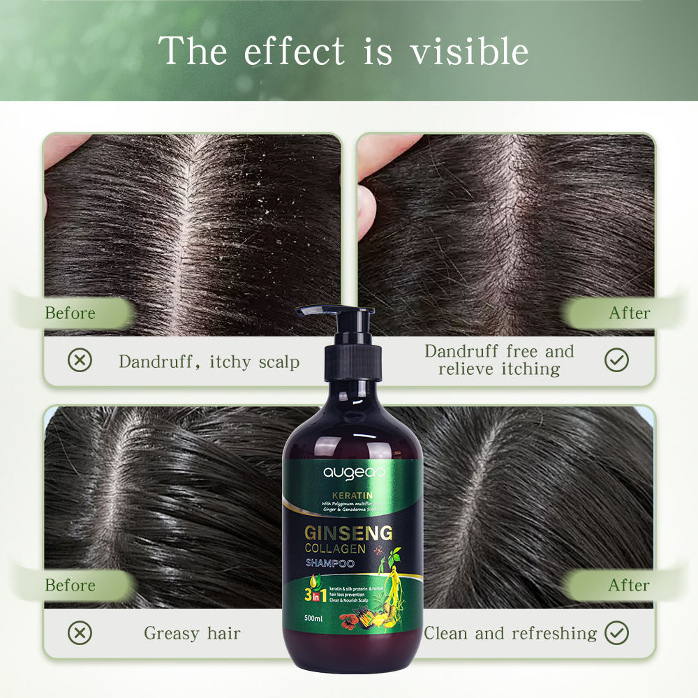 Wholesale Augeas collagen herbal natural karatin anti dandruff control oil hair shampoo