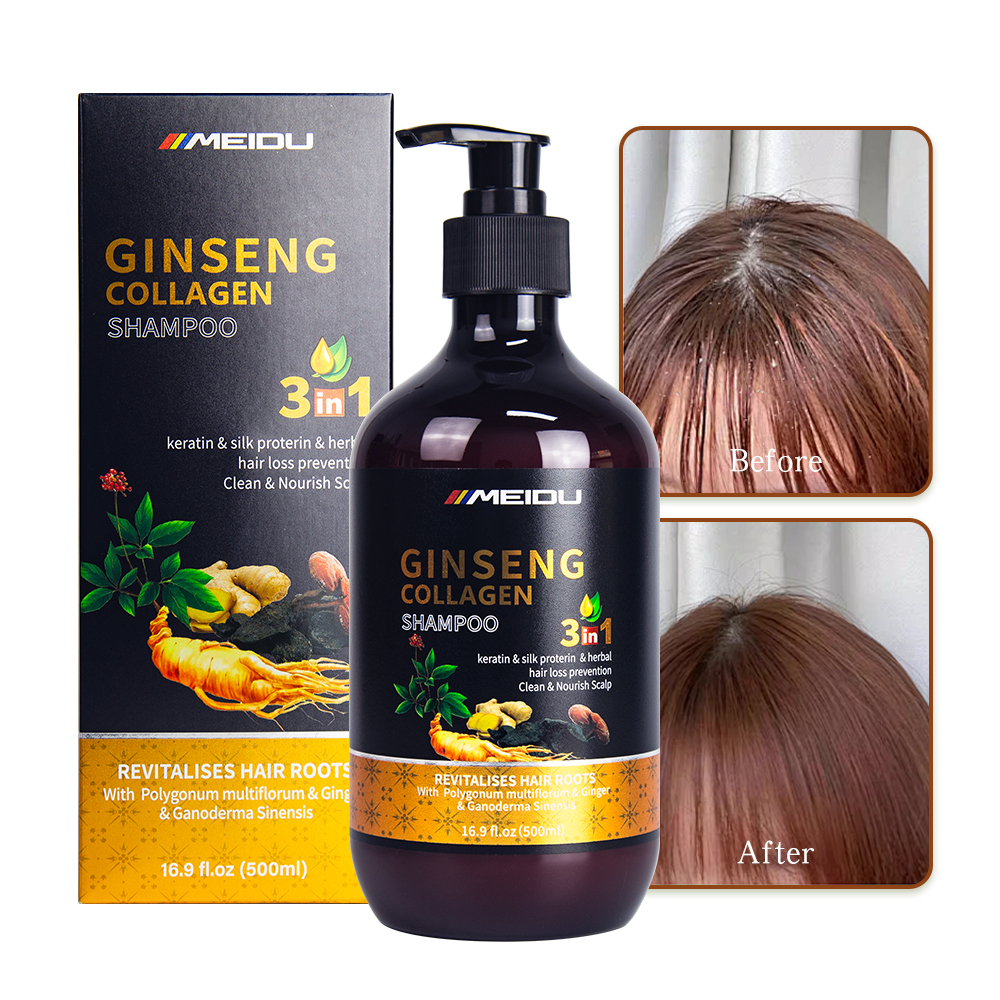 Meidu collagen herbal natural anti dandruff scalp care control oil hair shampoo
