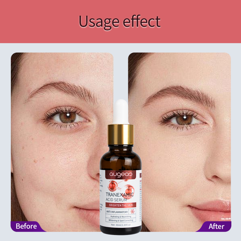 Skin Care Products Dark Spot Niacinamide Brightening Anti Aging Whitening Tranexamic Acid Facial Face Whitening Face Serum