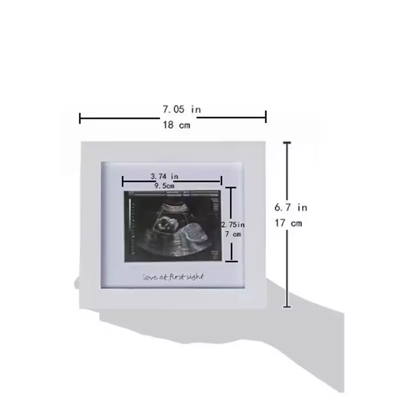 Wholesale Baby B Ultrasound Souvenir Photo Frame Meaningful Picture Frame for Family