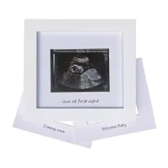 Wholesale Baby B Ultrasound Souvenir Photo Frame Meaningful Picture Frame for Family