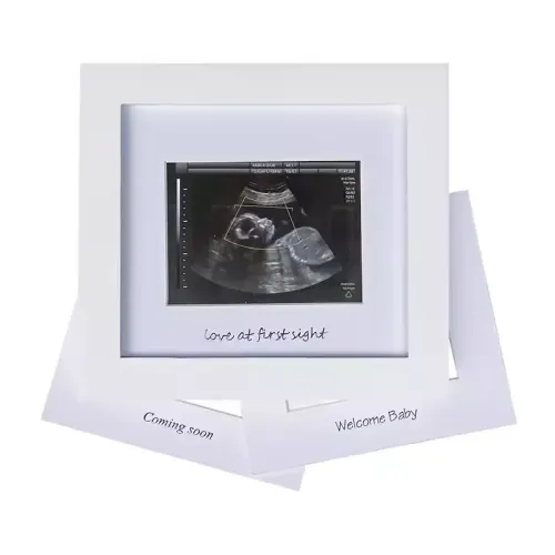 Wholesale Baby B Ultrasound Souvenir Photo Frame Meaningful Picture Frame for Family