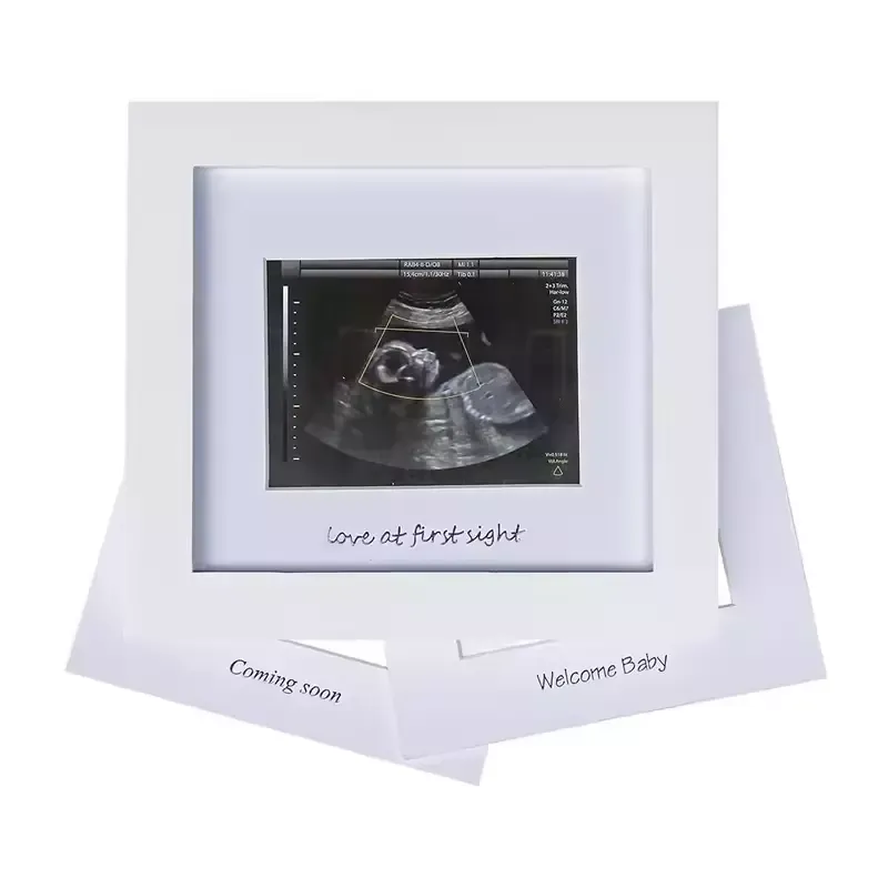 Wholesale Baby B Ultrasound Souvenir Photo Frame Meaningful Picture Frame for Family