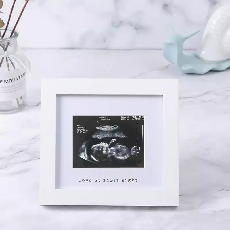 Wholesale Baby B Ultrasound Souvenir Photo Frame Meaningful Picture Frame for Family