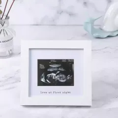 Wholesale Baby B Ultrasound Souvenir Photo Frame Meaningful Picture Frame for Family