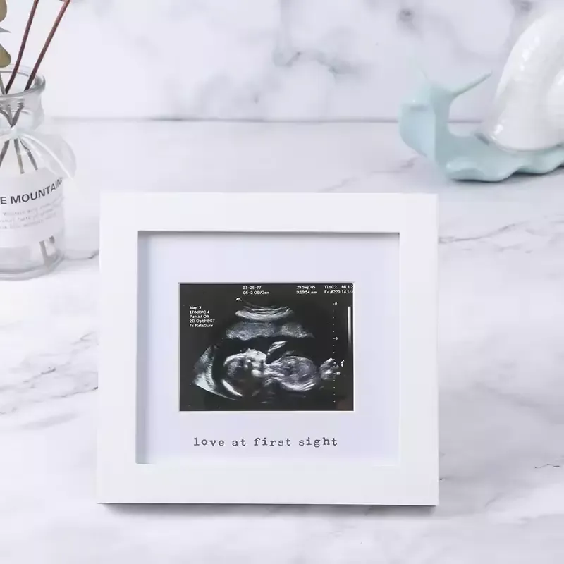 Wholesale Baby B Ultrasound Souvenir Photo Frame Meaningful Picture Frame for Family
