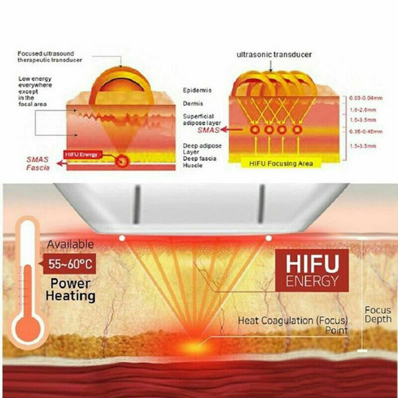 Professional High Intensity Focused Ultrasound Hifu Vmax Machine Face Lift Anti Aging Wrinkle Removal Body Slimming Beauty Equipment