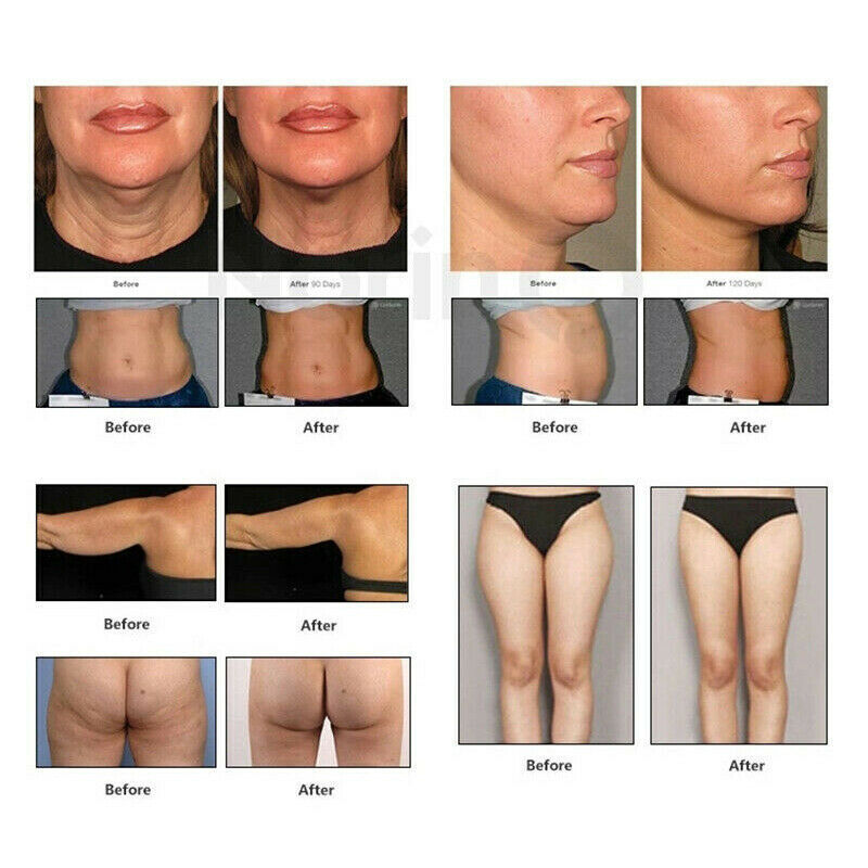 Professional High Intensity Focused Ultrasound Hifu Machine 10000 Flash Face Lift Skin Tighten Wrinkle Removal Body Slimming Beauty Salon Home Use