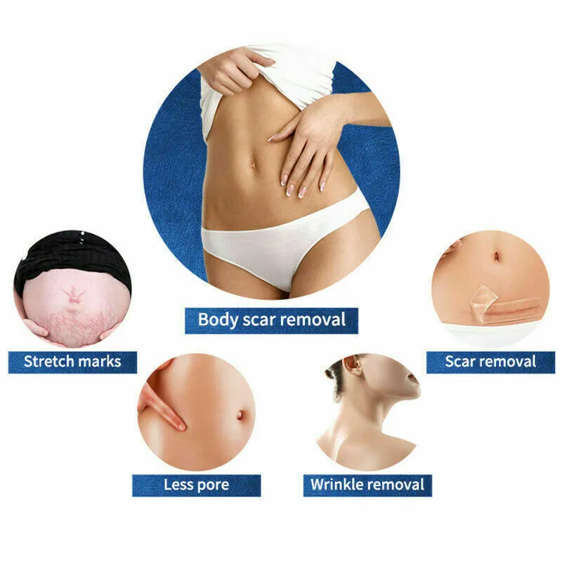 Portable 2in1 Microneedle Fractional RF Machine Micro Needle Equipment Skin Care Beauty Device Wrinkle Removal Face Lifting Tighten Shrink Pores Anti Stretch Marks