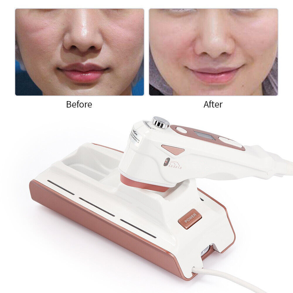 Ultrasound Hifu Machine Helloskin Mini Portable Face Lifting Tightening Skin Care Tools High Intensity Focused Home Beauty Devices