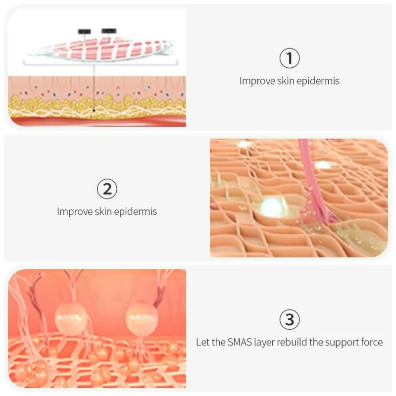 Ultrasound Hifu Machine Helloskin Mini Portable Face Lifting Tightening Skin Care Tools High Intensity Focused Home Beauty Devices