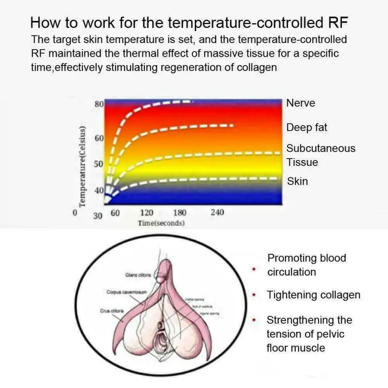 Portable Korea Technology Aesthetic Smooth Vaginal Tightening RF Private Care Machine CE