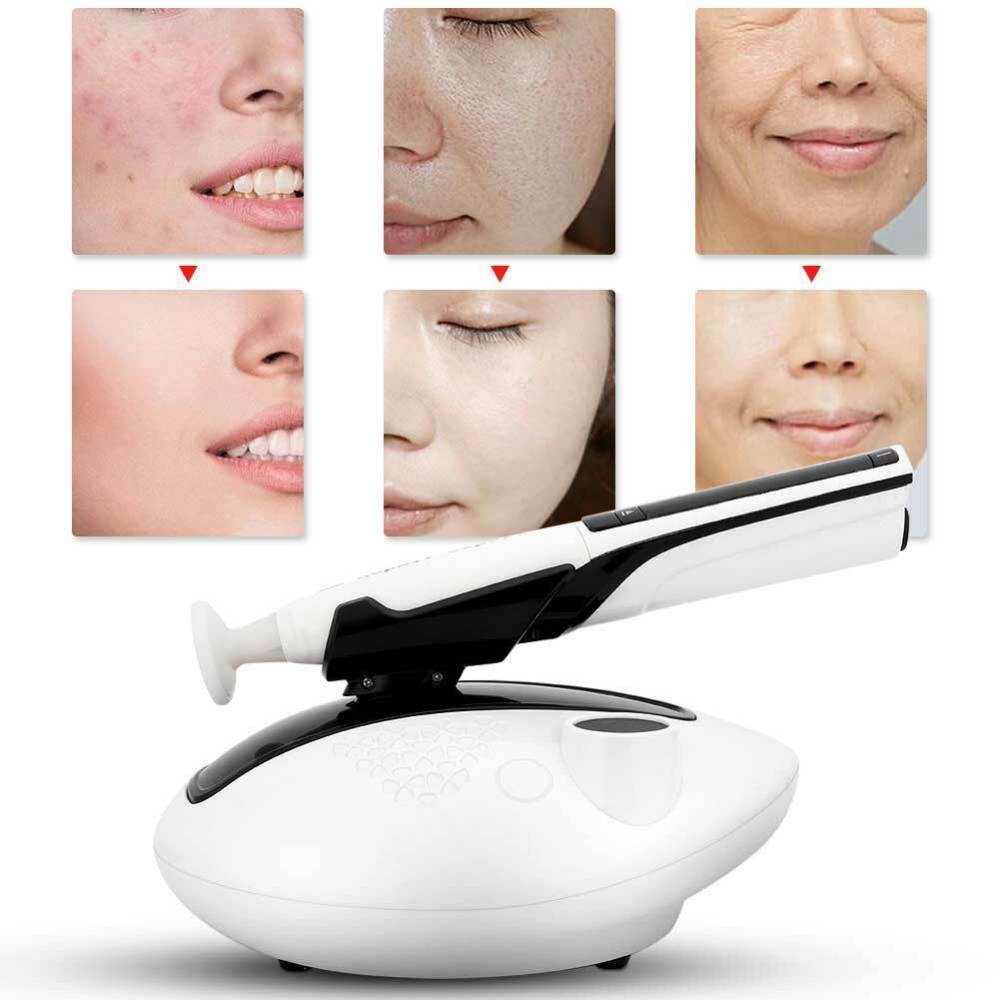 Ozone Plasma pen Eyes Lifting Face Skin Tightening Anti Acne Anti Bacterial