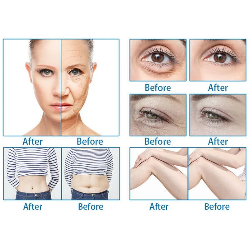 Portable Professional Multi-Functional Beauty Equipment Ultrasound 7D HIFU Machine Face Eyes Lifting Body Slimming Skin Tightening Wrinkle Removal