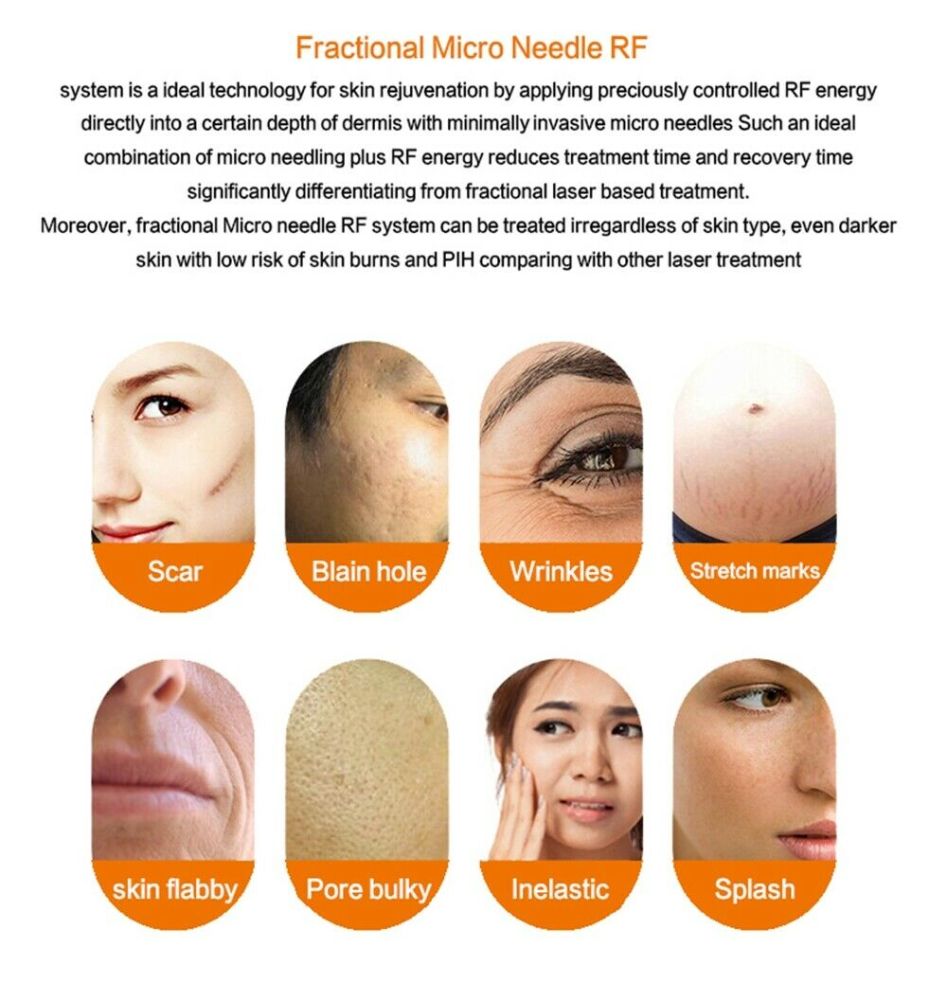 Fractional RF Microneedle Machine For Face Lifting Wrinkle Acne Scar removal