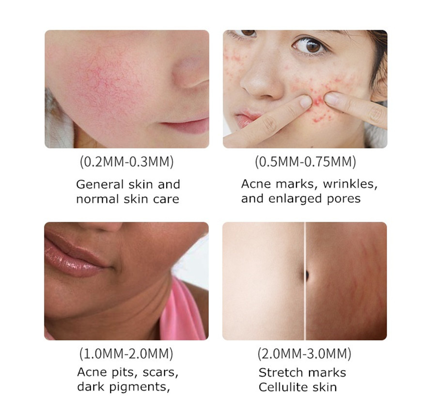 Price for 6pcs DRS Dr Stamp Titanium 40pins MicroNeedle Treatment for Skin Care Anti Scars ( leave note for mix needle length )