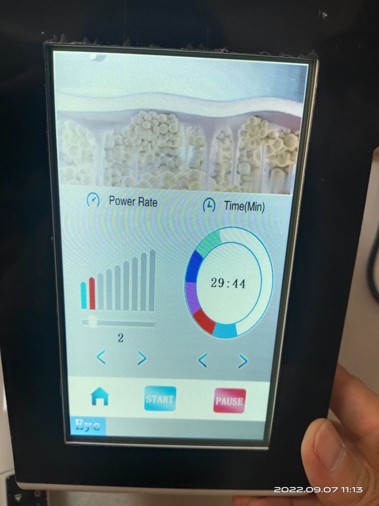 Portable Plasma Pen RF Machine for Eyes Lifting Anti Eye Bag Pattern Dark Circle