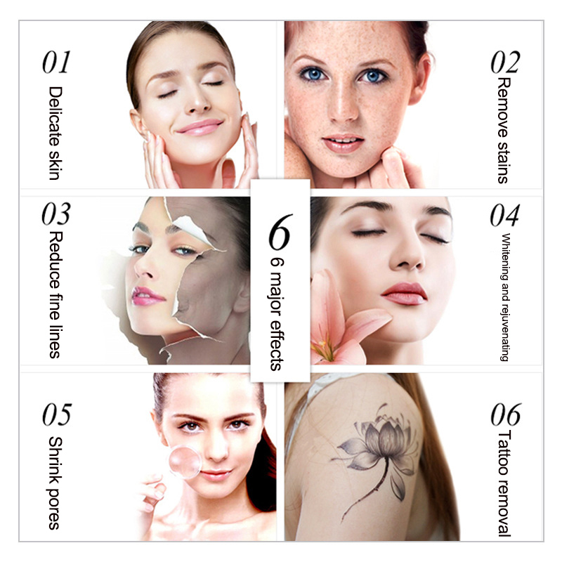 Professional Carbon Peel Laser Q Switched Nd Yag Laser Tattoo Removal Machine