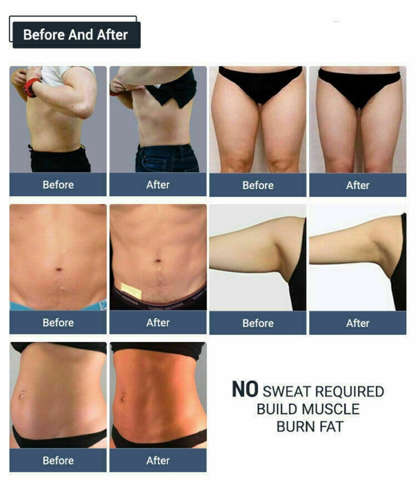 Emslim Neo RF Muscle Stimulator Body Contouring Butt Sculpting EMS Machine