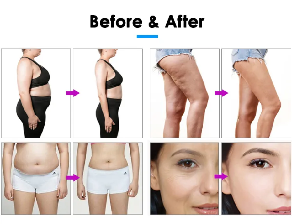 Portable Body Shaping Endo Lymphatic Drainage Spheres Machine Inner Ball Roller Cellulite Reduction Slimming Equipment