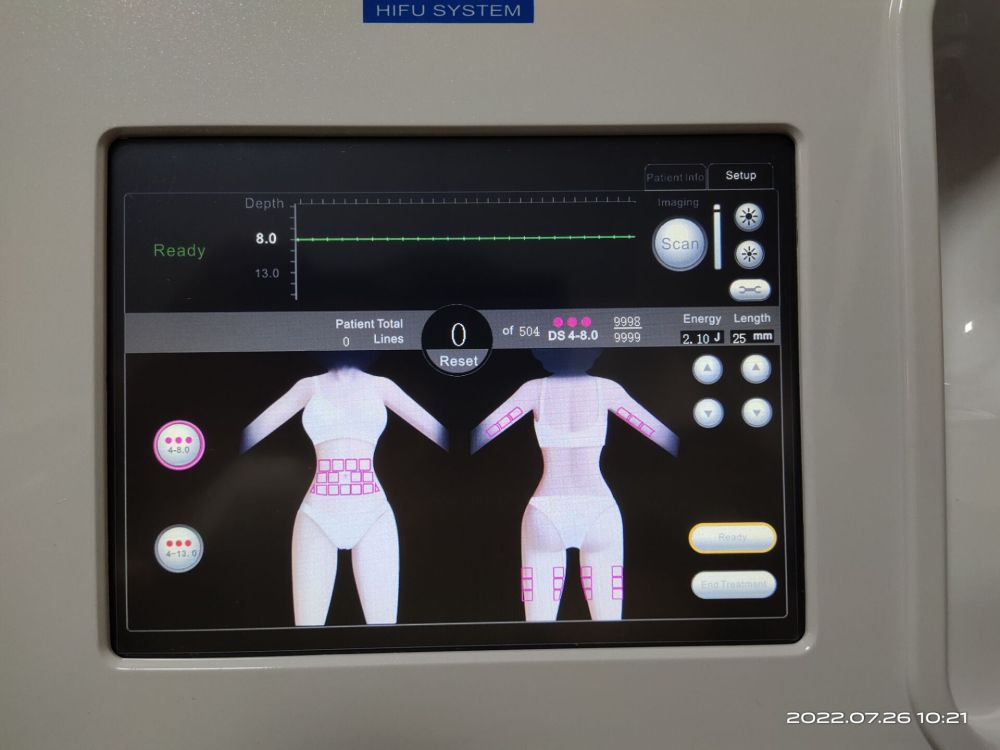 Only Machine Body Hifu Machine ( not include the handle and hifu cartridges )